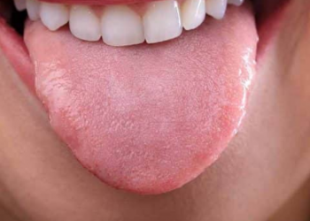 Découvrez pourquoi il est mauvais de se brosser la langue